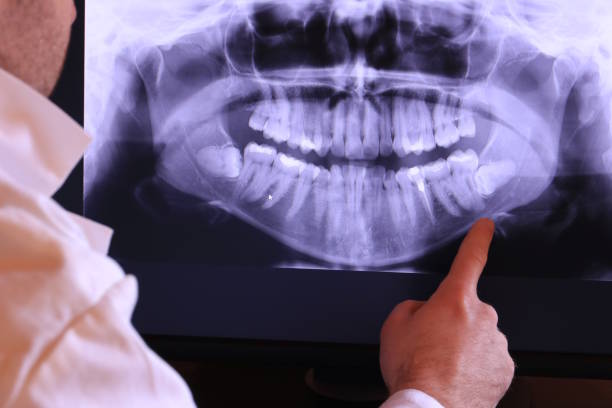 Best Emergency Root Canal Treatment in Wharton, TX